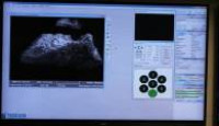 image The Curse of Oak Island season 5 episode 6